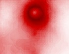 rheumatischen geschwollenes knie